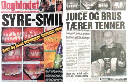 illustrasjon: Ungdoms orale helse i Norge ved tusenårsskiftet