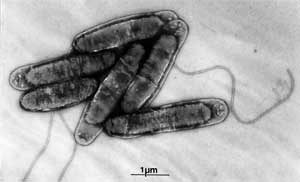 illustrasjon: Legionella og andre mikrober i vann fra dentaluniter – et helseproblem?