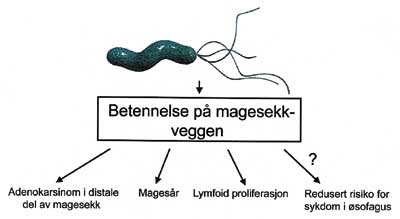 illustrasjon: Helicobacter pylori har sin nisje i magesekken, men den kan også påvises i munnhulen