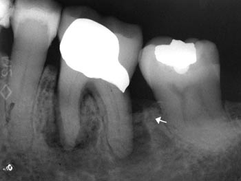 illustrasjon: Endodonti i et framtidsperspektiv