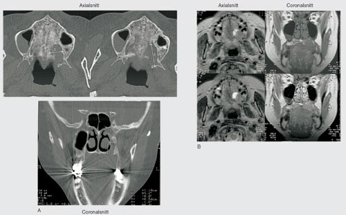 illustrasjon: Kjeve- og ansiktsradiologi – fremtidsperspektiver