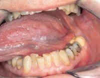 illustrasjon: TSE Modul 1: Oral medisin & Gerodontologi