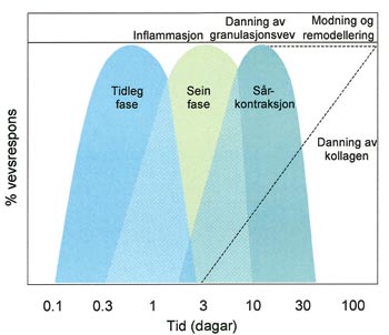 illustrasjon: Suturmateriale ved oralkirurgiske inngrep