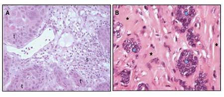 illustrasjon: The malignant phenotype