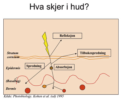 illustrasjon: Laser – skal, skal ikke?