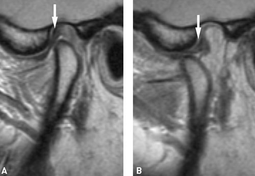 illustrasjon: Avansert maksillofacial bildediagnostikk med vekt på magnetisk resonanstomografi