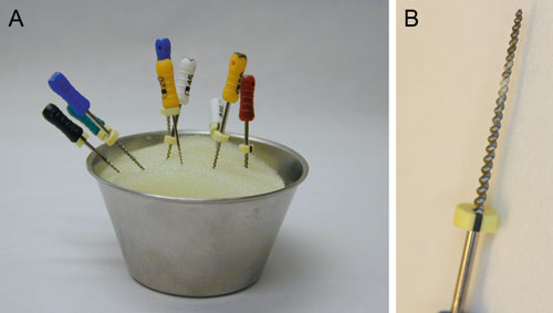 illustrasjon: Prioner og endodonti – engangs- eller flergangsbruk av rotkanalinstrumenter?