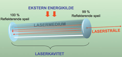 illustrasjon: Laserbehandling av infeksjoner ved tenner og dentale implantater