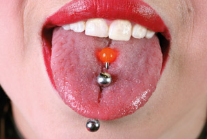 illustrasjon: Piercing gir vevsforandringer