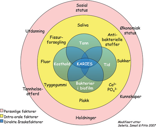 illustrasjon: Non-operativ vs operativ behandling av karies blant barn og unge