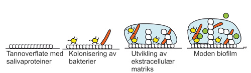 illustrasjon: Biofilmdannelse på orale proteser