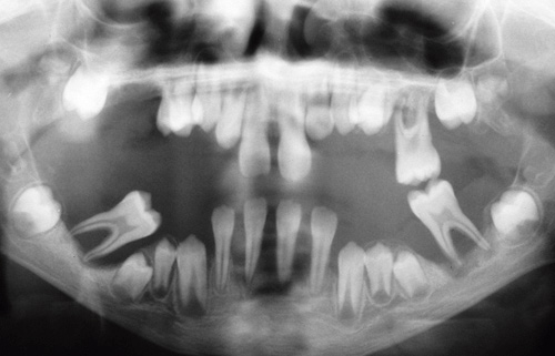 illustrasjon: Genetisk test hos tandlægen?