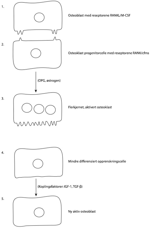 illustrasjon: Osteoporose, dentale implantater og ortodonti