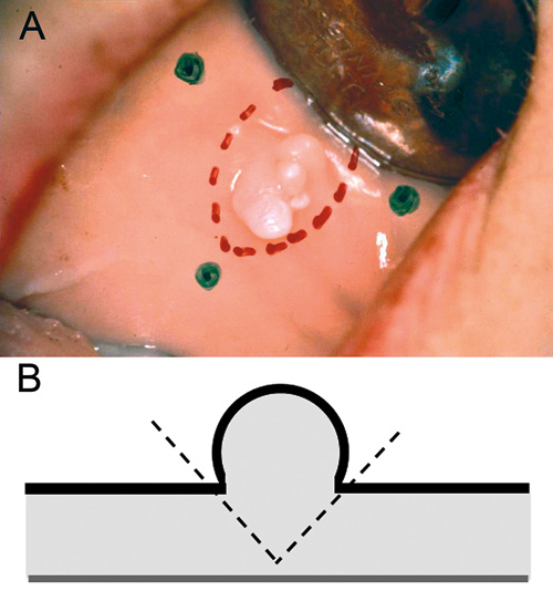 illustrasjon: Biopsier i odontologisk praksis - håndtering og innsendelse
