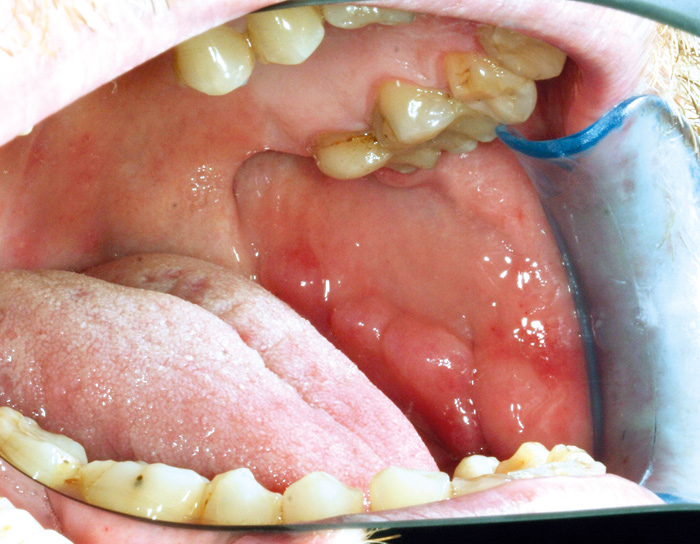 Diagnostics of oral mucosae - Den norske tannlegeforenings Tidende