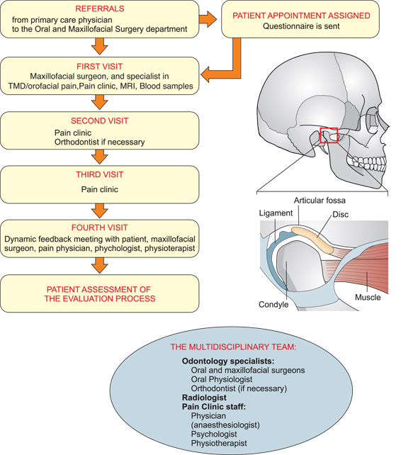 illustrasjon: Assessment of patients with severe temporomandibular disorder in Norway - a multidisciplinary approach