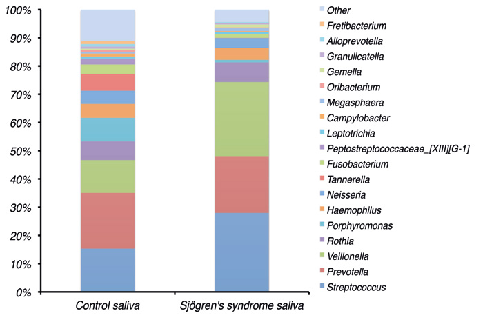illustrasjon: Primært Sjögrens syndrom karakteriseres av mikrobiell dysbiose (ubalanse) selv ved normal spyttsekresjon