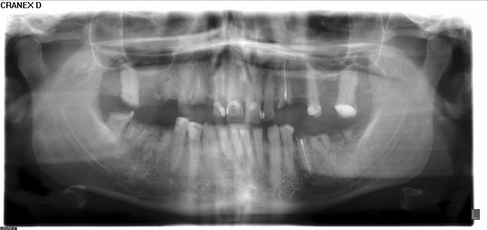 illustrasjon: Tilrettelagt tannhelsetilbud: Erfaringer med tverrfaglig behandling av pasient med sammensatt odontologisk og psykologisk problematikk