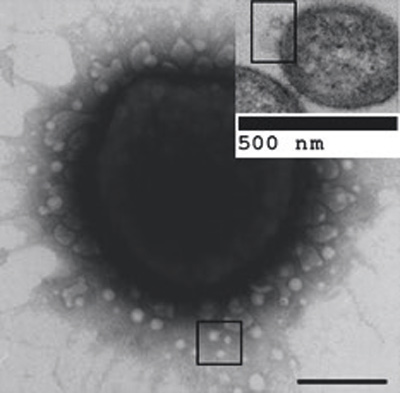 illustrasjon: Kan ytre membranvesikler tjene som «microbullets» for sporadisk Alzheimers sykdom?