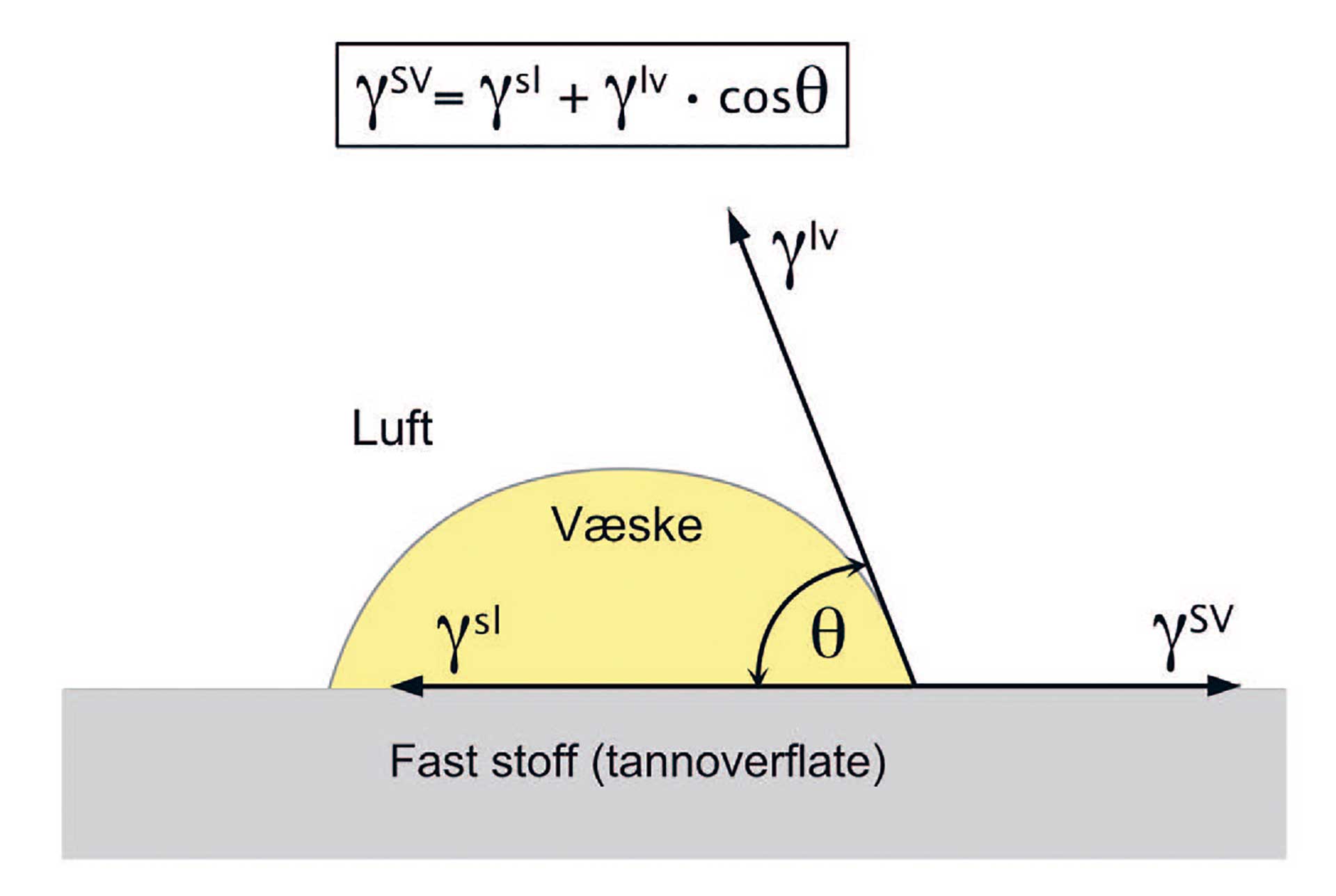 illustrasjon: Kan tannpasta gjøre tennene mer sårbare?