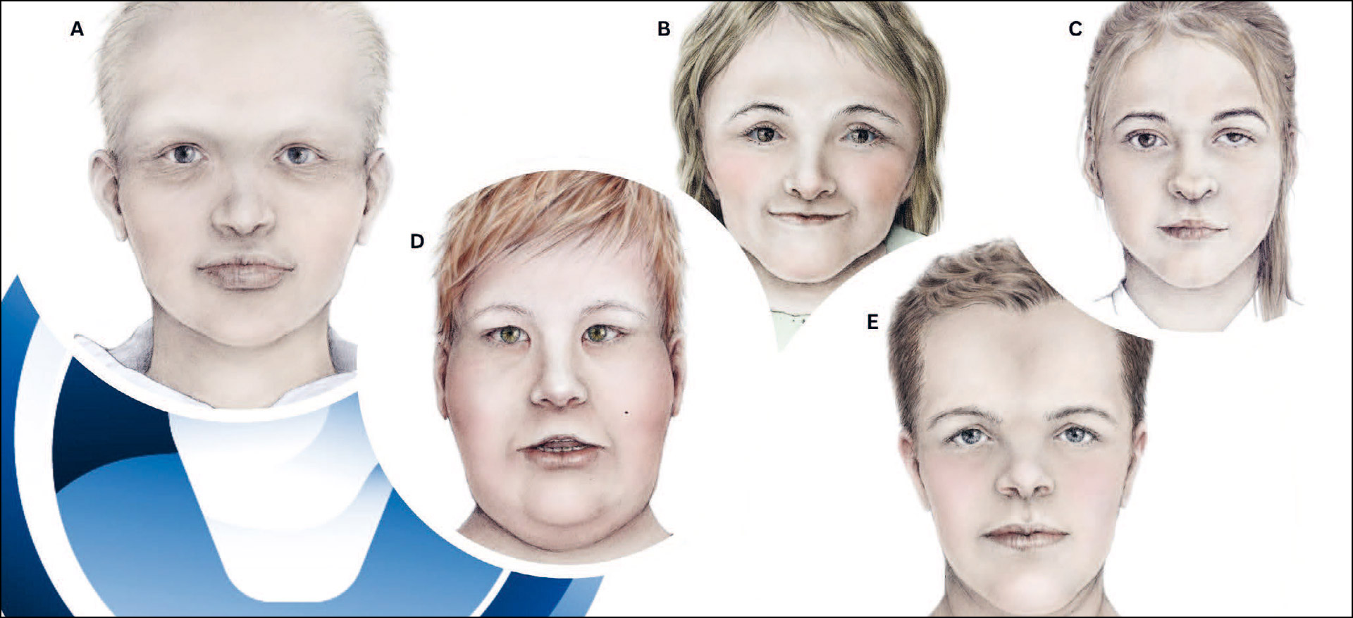 illustrasjon: 2025/10/Unike-tenner-for-tannlegen-ved-sjeldne-diagnoser