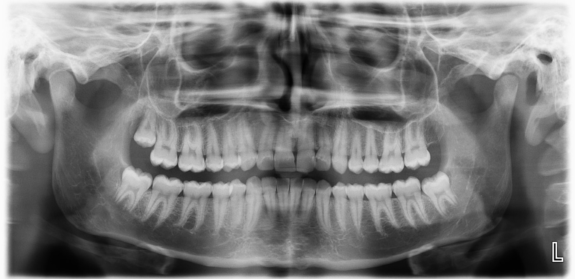 illustrasjon: 2026/01/Age-estimation-by-means-of-teeth