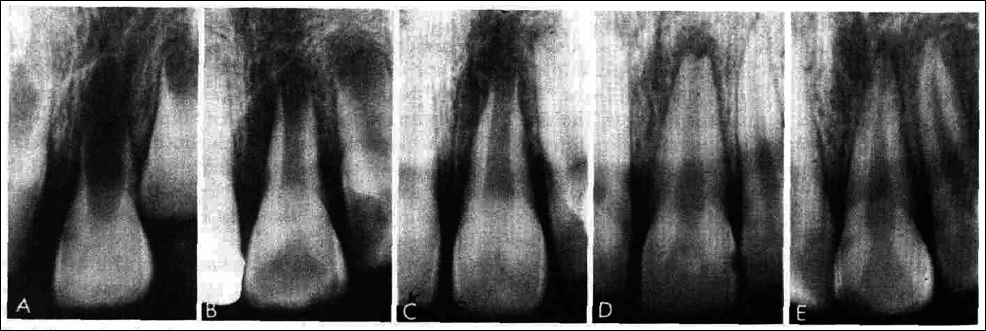 illustrasjon: 2026/06/Kliniske-retningslinjer-for-diagnostik-og-behandling-af-pulpitis-og-apikal-parodontitis