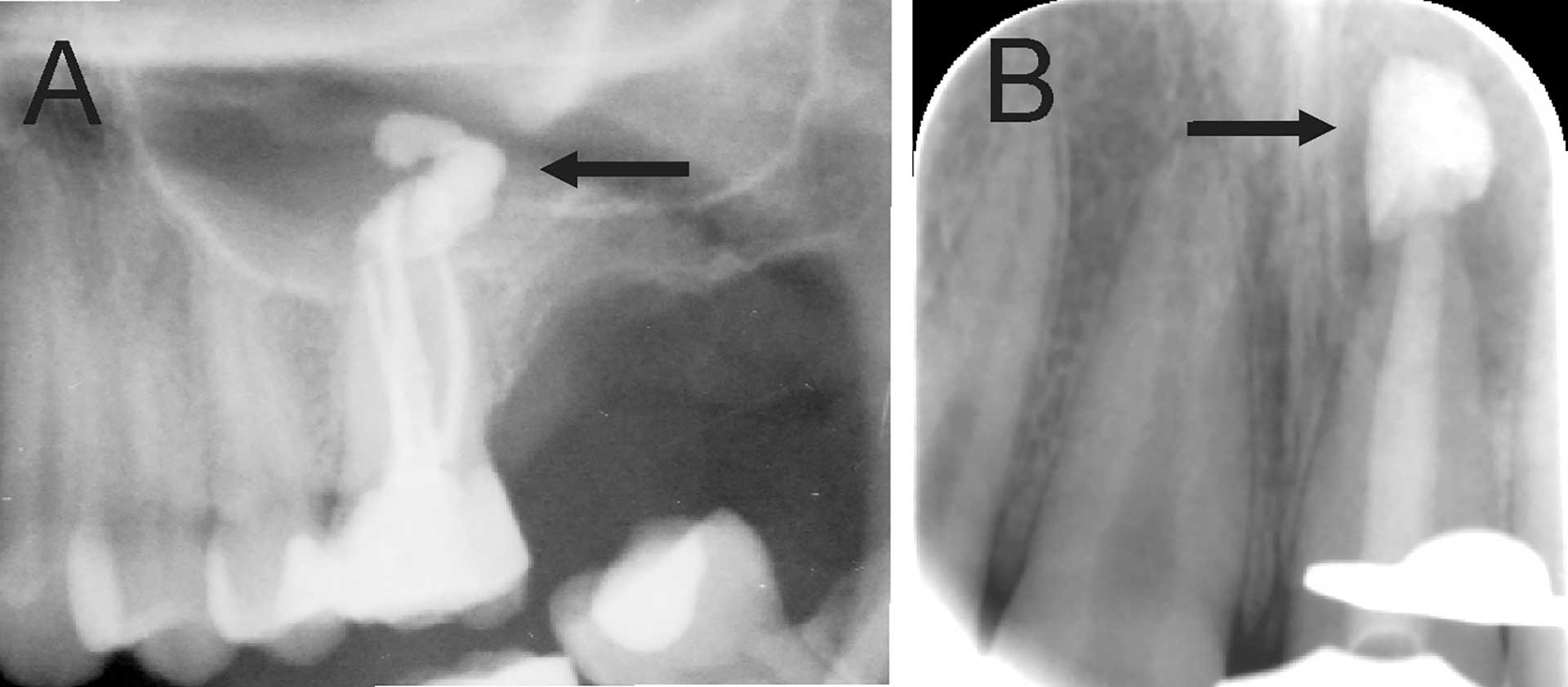 illustrasjon: «Nordic Endodontic Assessment Form» – en evaluering av kasusvanskelighet, behandlers ferdigheter og henvisningsrutiner