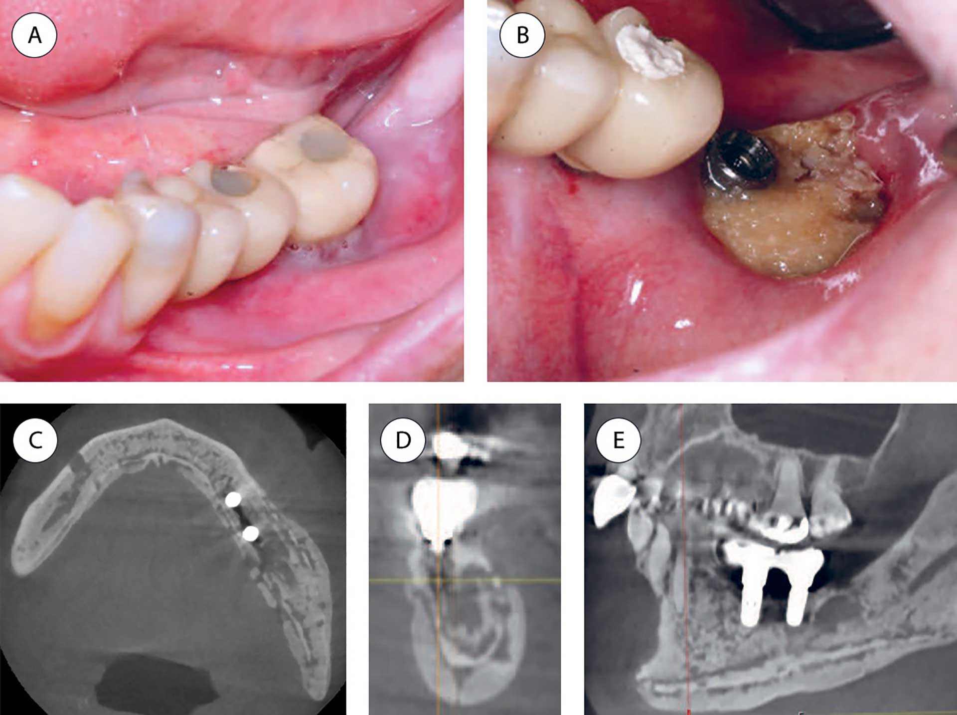 illustrasjon: Oral manifestations of systemic disorders – part 2